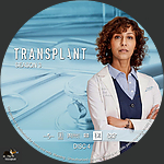 Transplant_S3D4.jpg